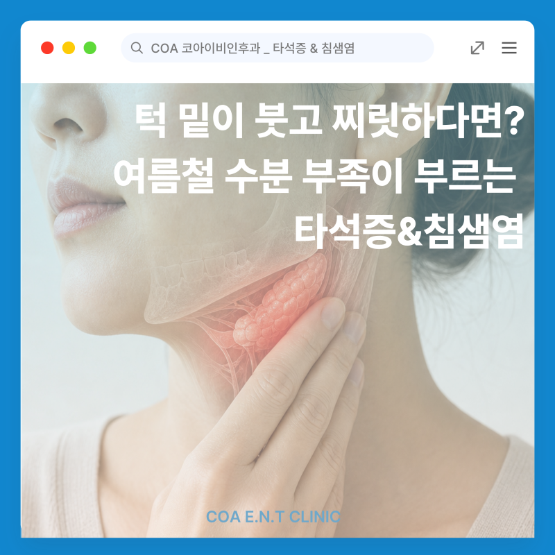 턱 밑이 붓고 찌릿하다면? 여름철 수분 부족이 부르는 '침샘염 & 타석증'