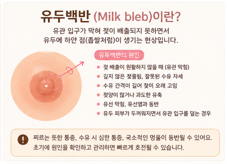 유선염 초기 증상, 유두백반이 원인이었던 실제 후기