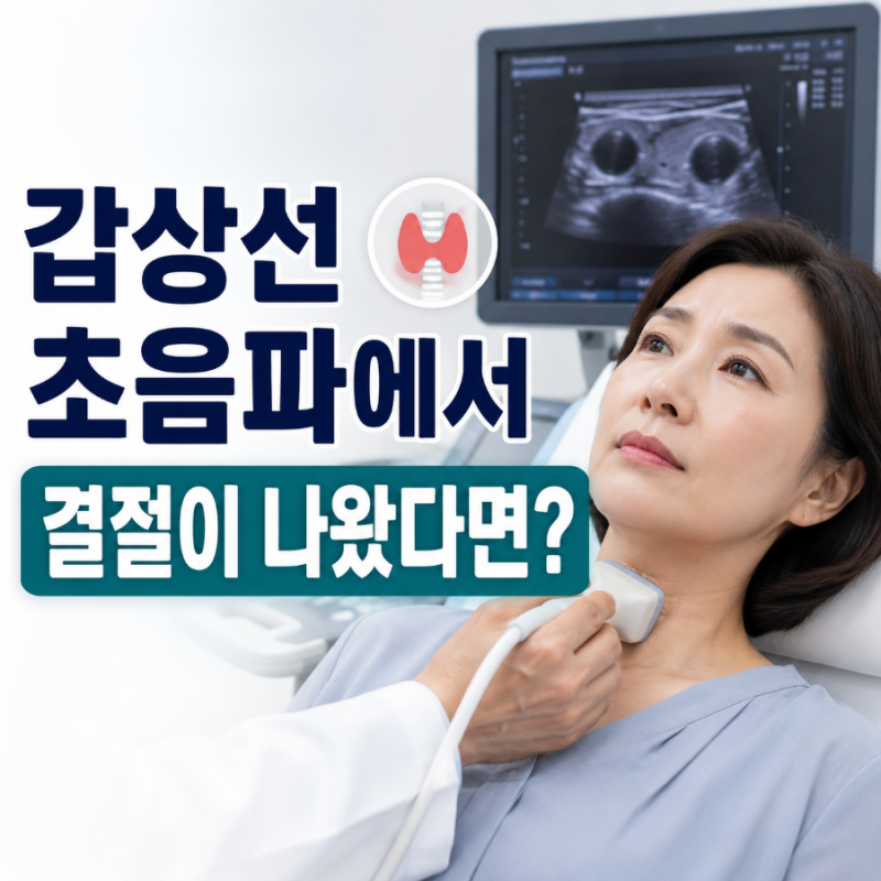 갑상선 초음파에서 결절이 나왔다면? 검진 결과지와 큰 병원 정밀검사에서 볼 것