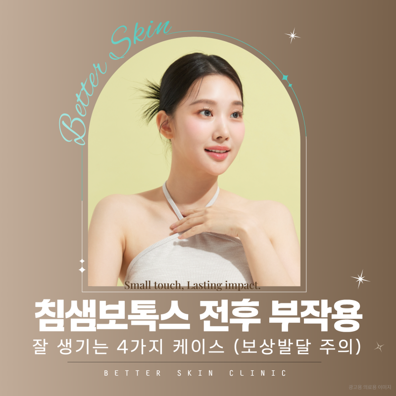 침샘보톡스 전후 부작용 잘 생기는 4가지 케이스 (보상발달 주의)
