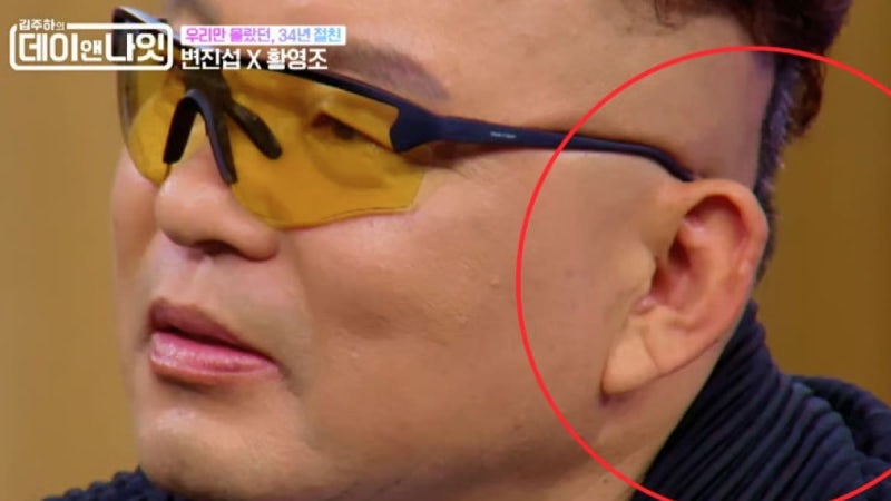 마라톤 영웅 황영조 피범벅 만들었던 국민 가수의 정체 "50바늘이나 꿰맸다"... "변진섭, 황영....