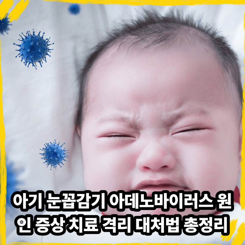 아기 눈꼽감기 아데노바이러스 원인 증상 치료 격리 대처법 총정리