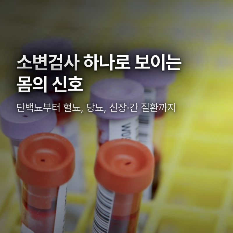 소변검사 하나로 알 수 있는 몸의 신호들, 어디까지일까