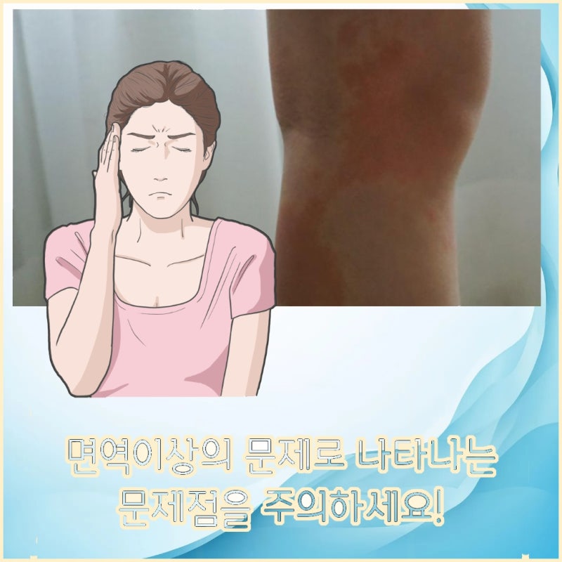 부산 강서 류마티스내과 피검사로 알 수 있는 자가면역질환은?