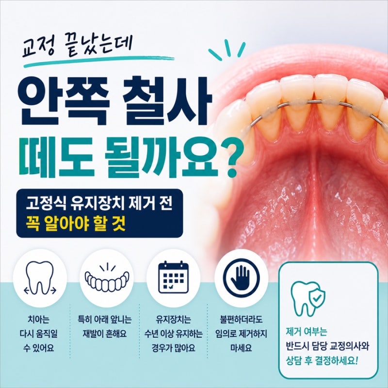 교정 끝났는데 안쪽 철사 떼도 될까요?｜고정식 유지장치 제거 전 꼭 알아야 할 것