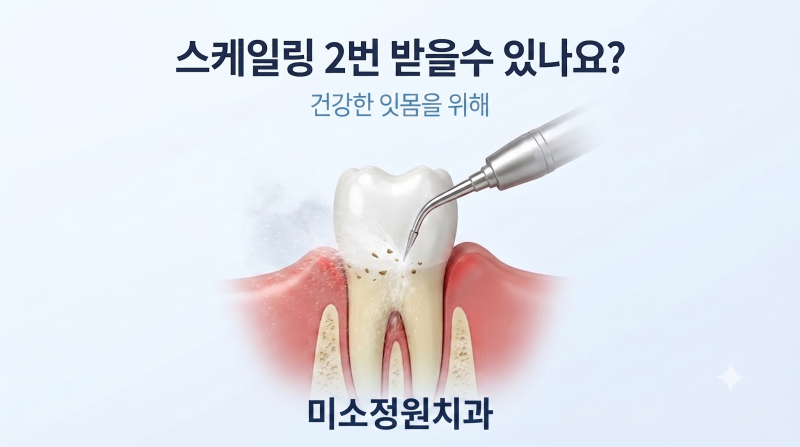 영등포구청 치과 스케일링 보험 적용 2번 받을 수 있나요?