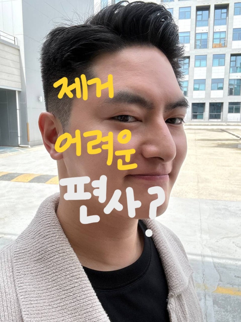 천안편평사마귀제거 피부과? 그동안 제거가 어려웠던 이유는