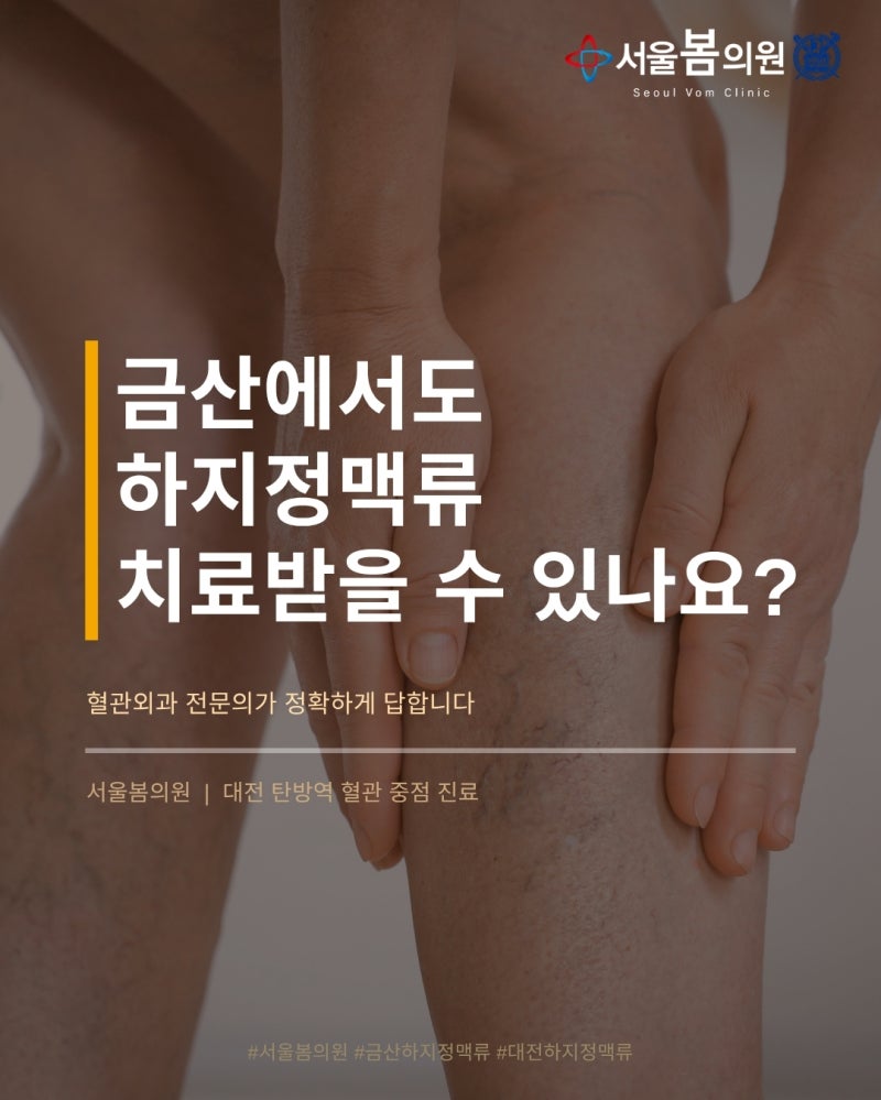 금산 하지정맥류 시술, 대전에서 받을 수 있어요 | 서울봄의원