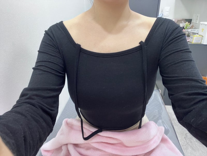 승모근보톡스 한달 후기|뽀샵 안 한 전후사진|서울 구로디지털단지역 승모근 보톡스 후기