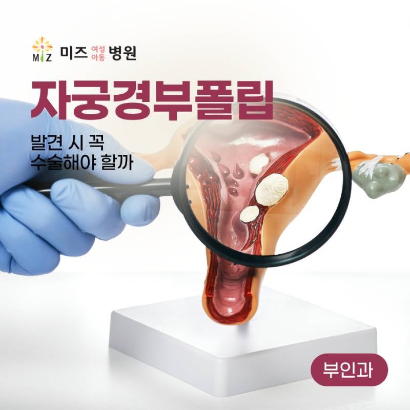 자궁경부폴립 발견 시 꼭 수술해야 할까