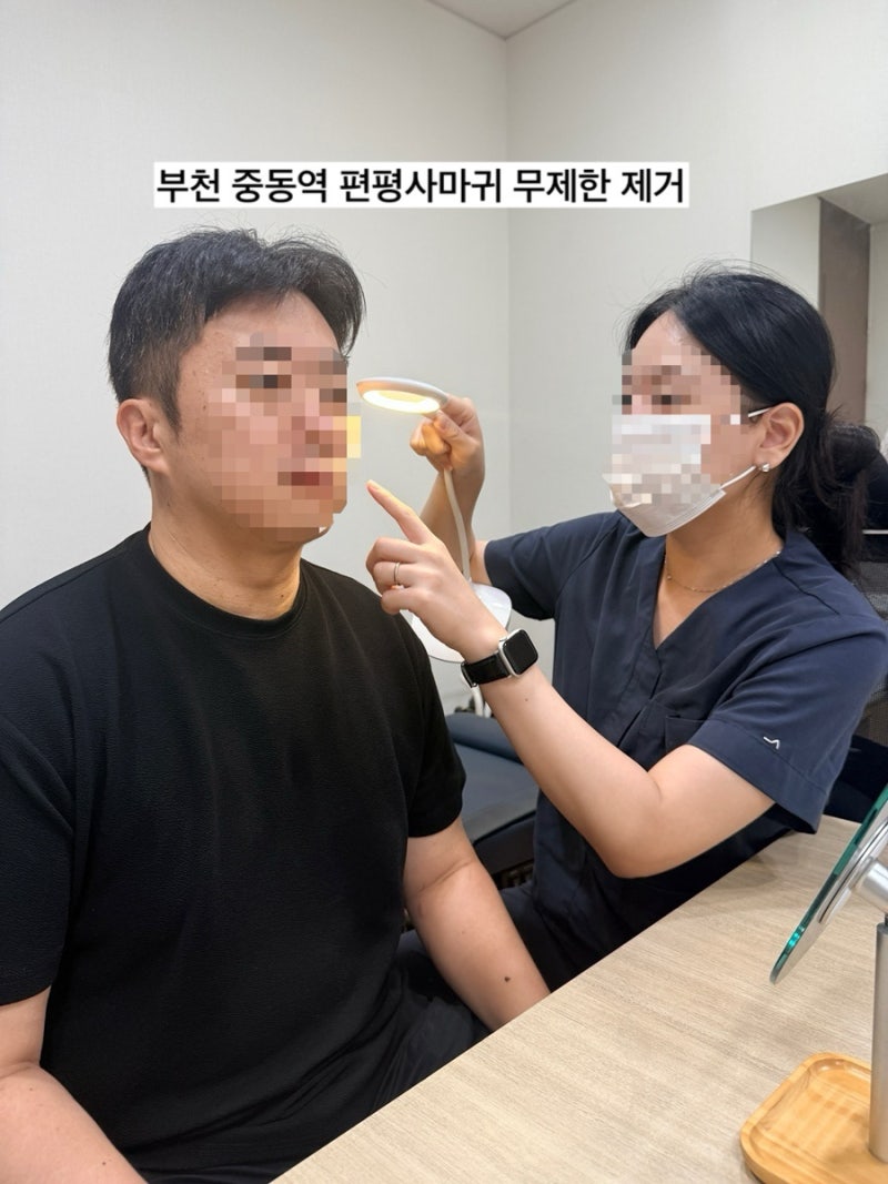 부천 중동역 얼굴, 목에 있는 편평사마귀, 쥐젖 무제한 제거 후기