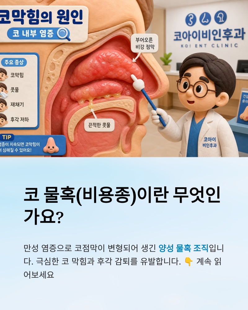 코안에 물혹(비용종)이 생겼을 때, 수술 없이 치료가 가능할까? (당진 코아이비인후과)