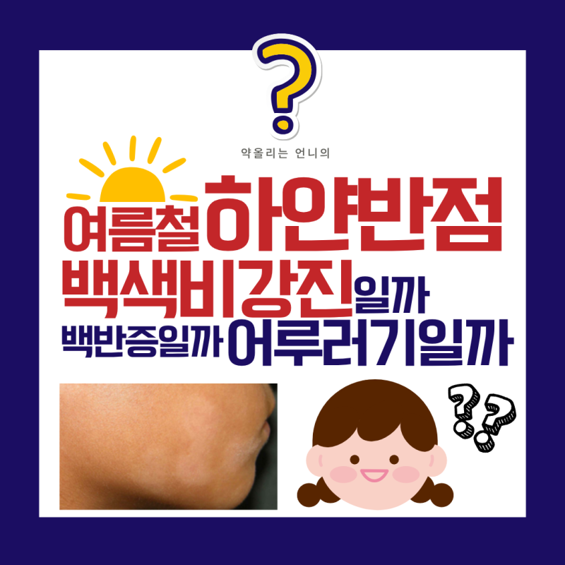 여름철 하얀 반점, 백반증일까 백색비강진일까? (아이 얼굴 하얀 자국의 정체)