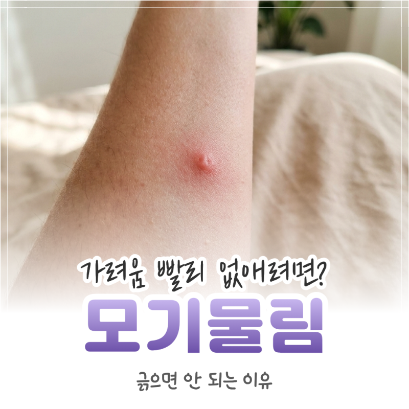 모기 물린 곳 가려움 빨리 없애는 법, 긁으면 안 되는 이유