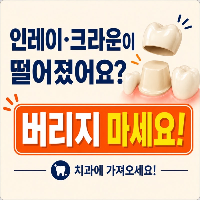 인레이·크라운이 떨어졌어요? 버리지 마세요!