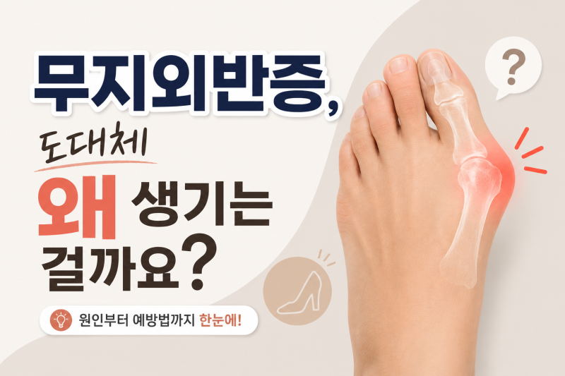 무지외반증, 도대체 왜 생기는 걸까요?