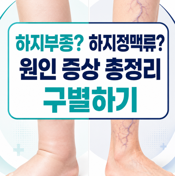 하지정맥류 vs 하지부종 터질듯한 다리 붓기 원인 증상 총정리하고 정확히 구별하기