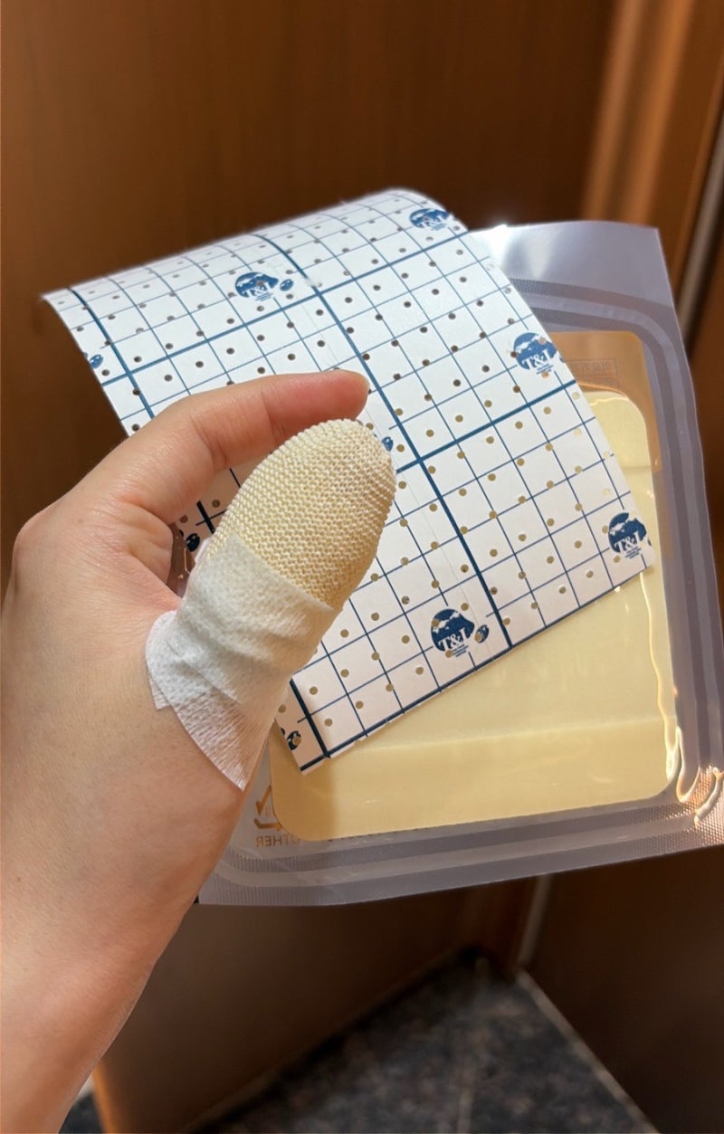 임산부 손가락 2도 화상 부산 화상병원 센텀화외과의원 다녀온 경과 및 치료 후기 (사진 혐오....