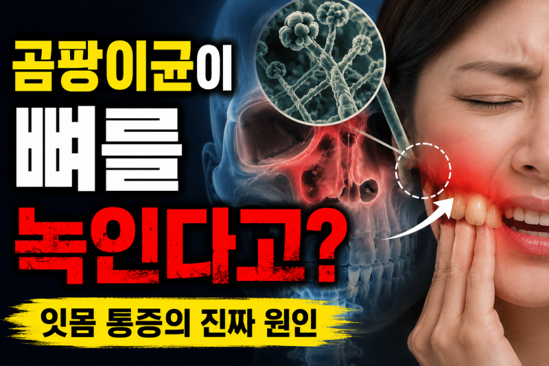 잇몸이 아파 치과 갔는데 곰팡이균 부비동염? 뇌뼈까지 침범할 수 있습니다