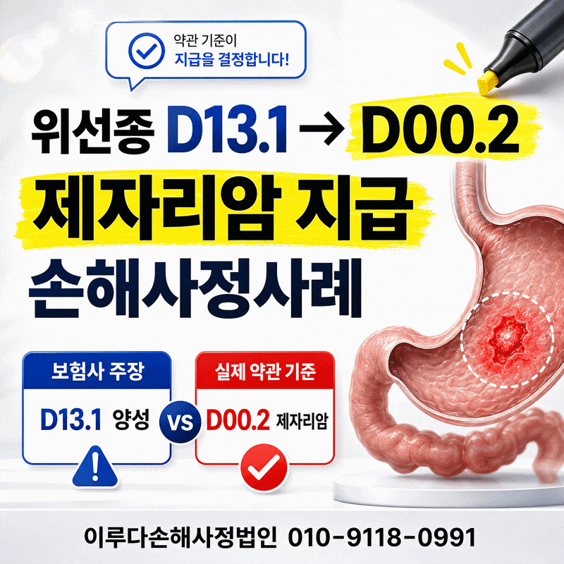 위선종 암진단비 D131 제자리암 D00.2로 뒤집힌 까닭 사례로 증명하기
