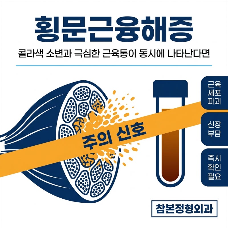 횡문근융해증, 콜라색 소변과 극심한 근육통이 동시에 나타난다면