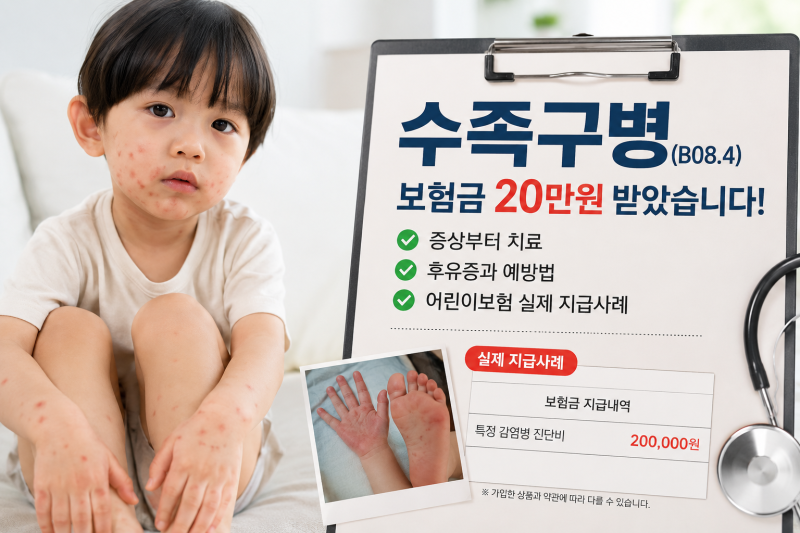 아이가 수족구병(B08.4) 진단받았다면? 보험금 20만원 받은 실제 사례와 증상·치료방법 총정리