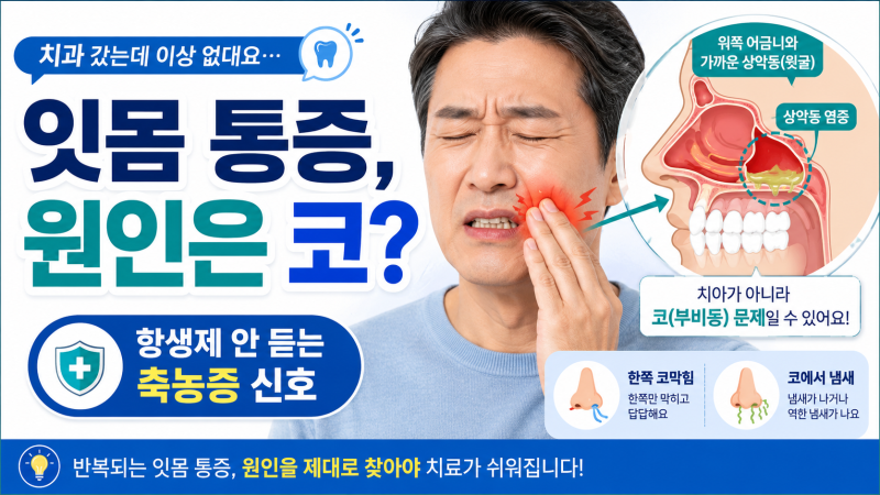 잇몸이 아파서 치과 갔는데 부비동염? 항생제 안 듣는 곰팡이균 축농증