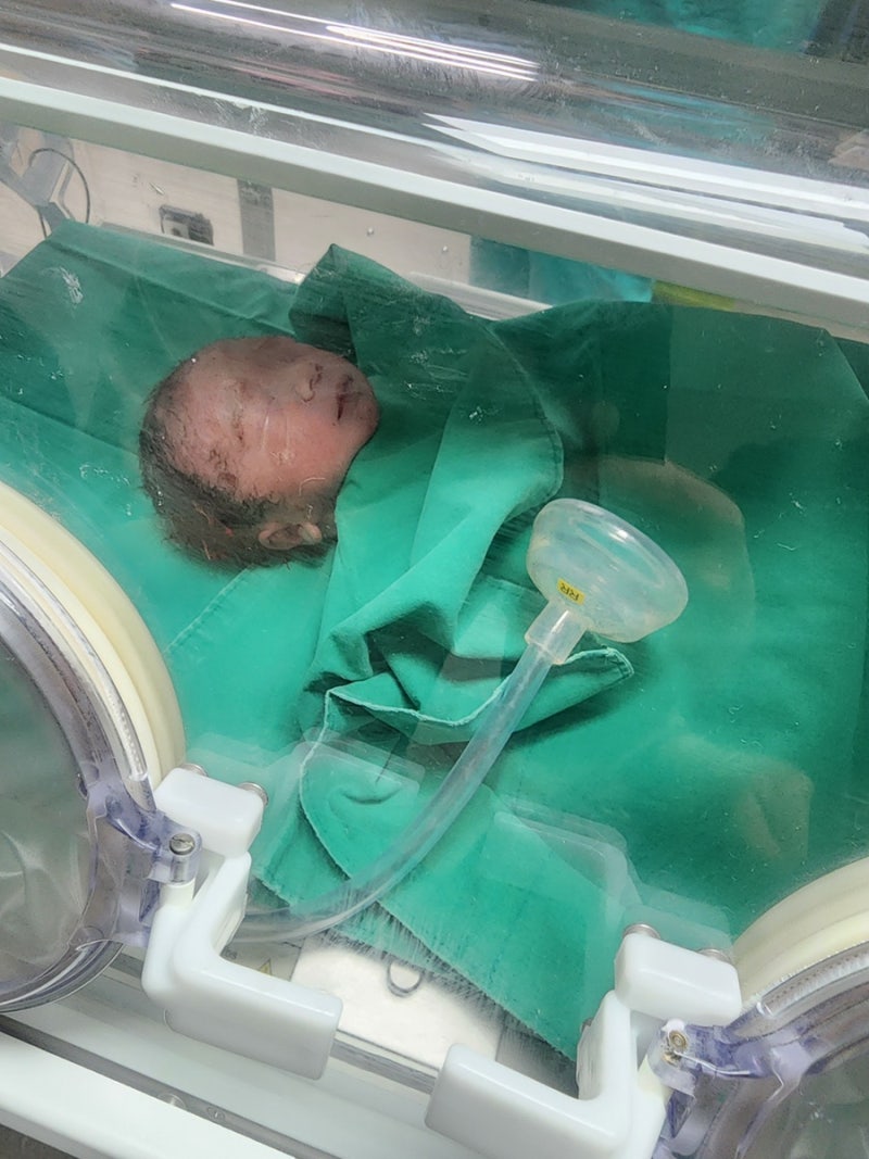 NICU 입원 후기 신생아 중환자실 미숙아 의료비 지원 태아보험청구