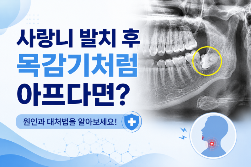 사랑니 발치 후 목감기처럼 아프다면? 침 삼킬 때 목 통증, 정상일까요? / 강남레옹치과