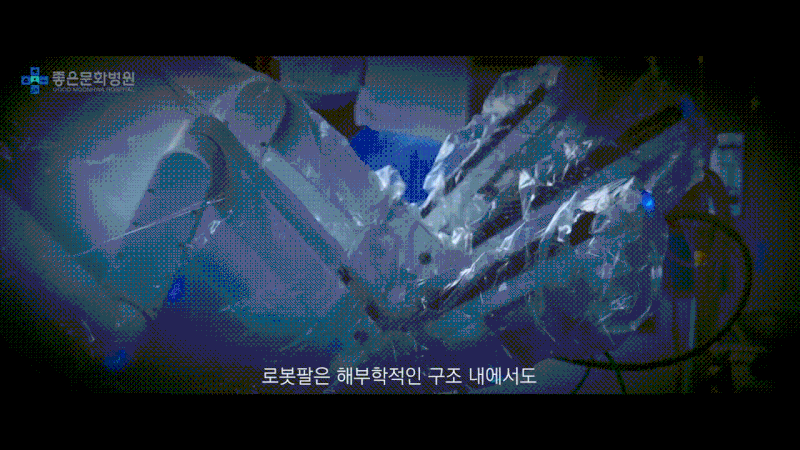 부산자궁로봇수술, 복강경과 로봇 중 맞는 방법은 상태에 따라 다릅니다