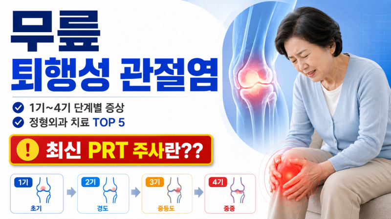 무릎 퇴행성 관절염 1기~4기 단계별 증상, 정형외과 치료 Top 5 및 최신 PRP 주사란?