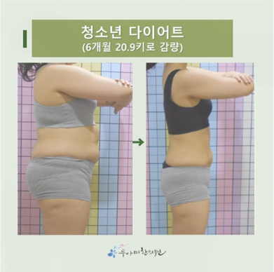 중학생 다이어트, 건강검진에서 고혈압이 함께 발견됐다면