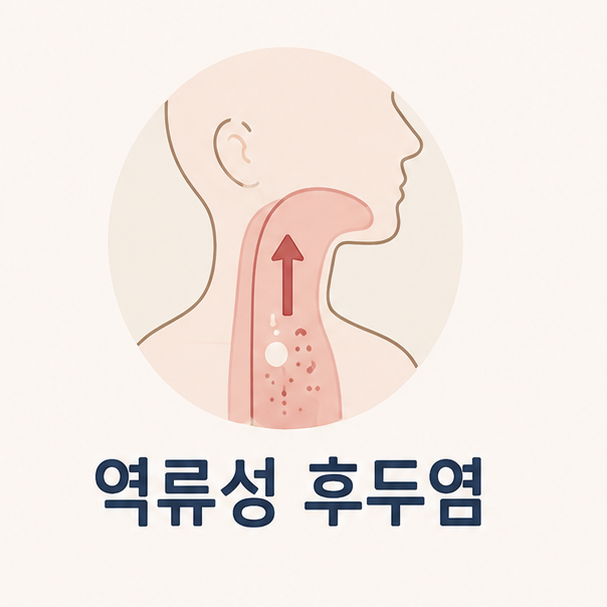 역류성 후두염 증상과 관리, 병원 갈 기준 간단히