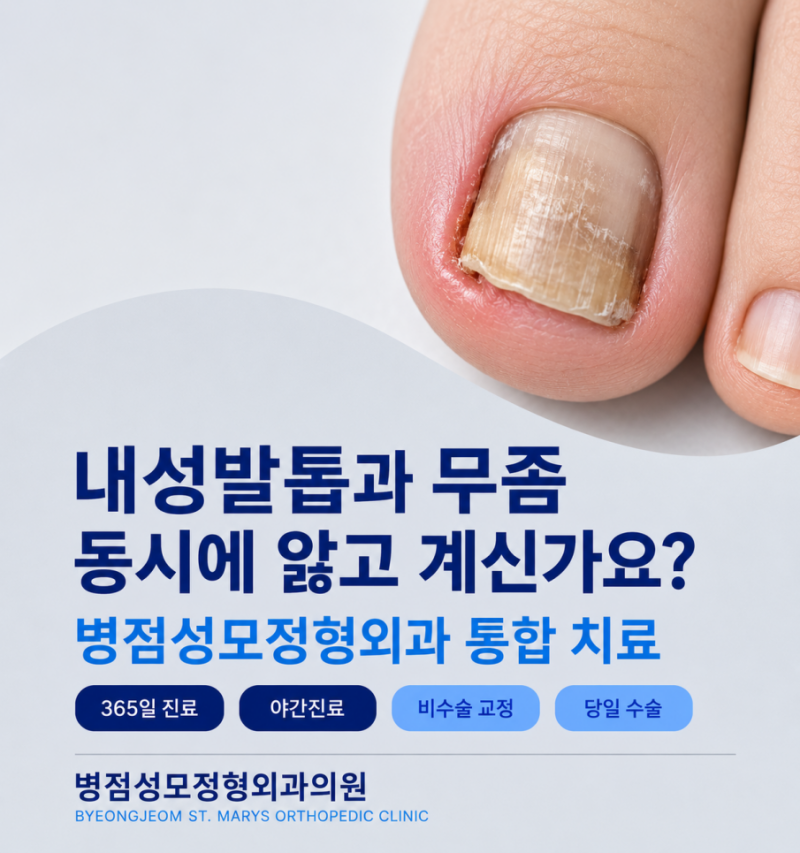 내성발톱과 무좀 동시에 앓고 계신가요? 동탄무좀병원 통합 치료