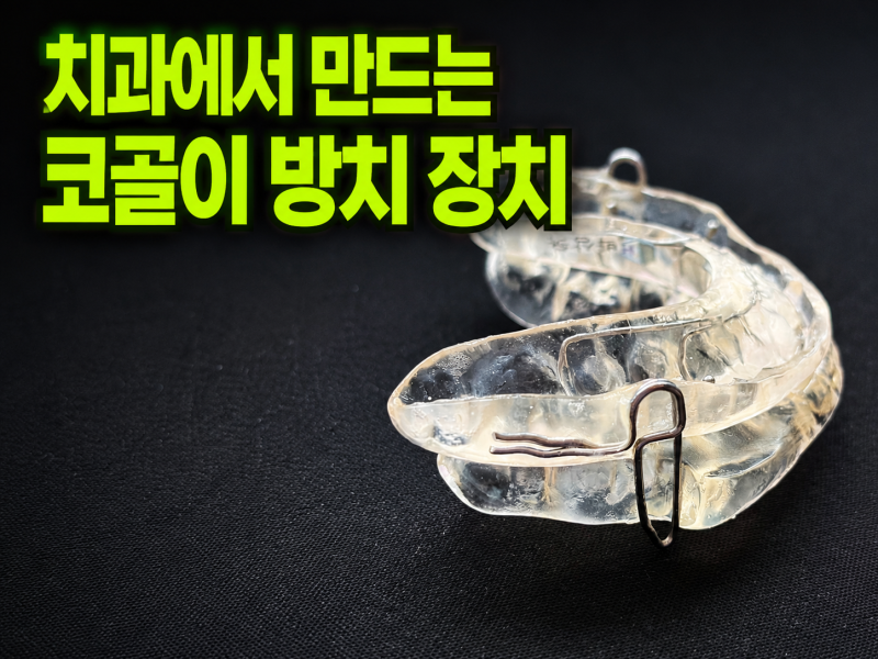 치과에서 만드는 코골이 방지 장치[가산동치과][가디치과][씨앤케이치과][구강내장치][코골....