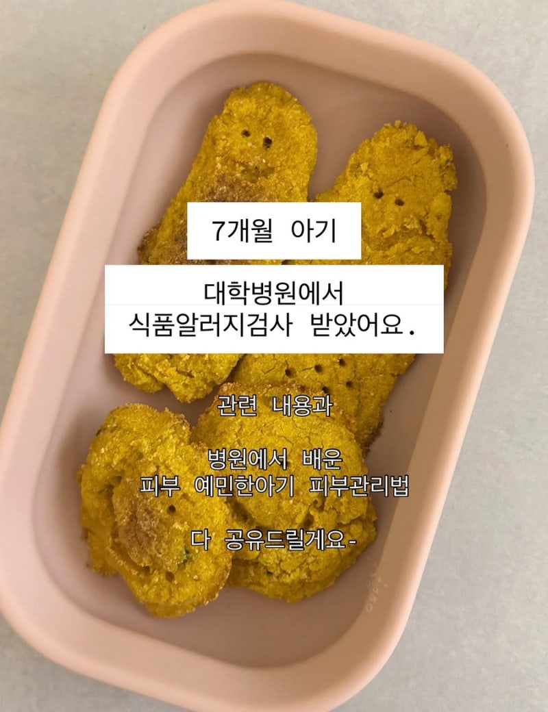 7개월 아기 대학병원 알러지검사, 피부관리법 및 화장품 공유(새살큐할인쿠폰⭕️)