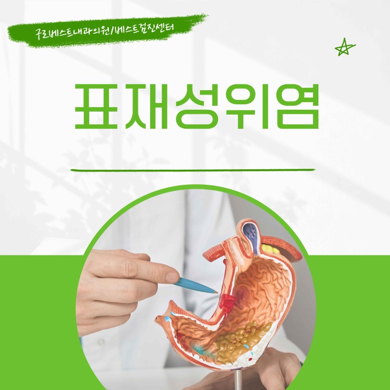 만성 표재성 위염이란? 증상과 치료에 도움되는 관리 방법은