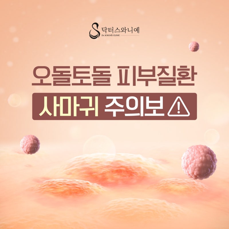 자꾸 번지는 손발에 생긴 못생긴 굳은살? 안양,범계,평촌 사마귀 치료법(feat.실비보험)