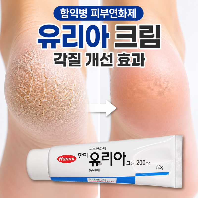 함익병 피부연화제, "유리아 크림" 발뒤꿈치 효과, 사용법 (ft.약국 가격)