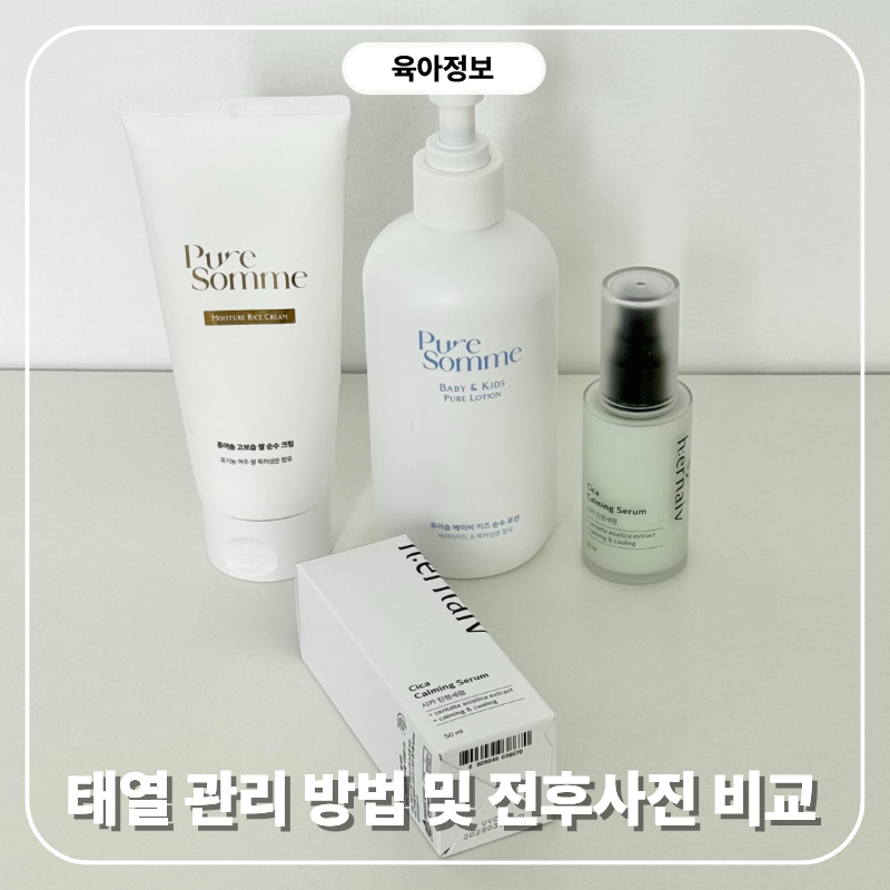 신생아 태열 관리 방법 전후 사진으로 보는 태열 변화 기록