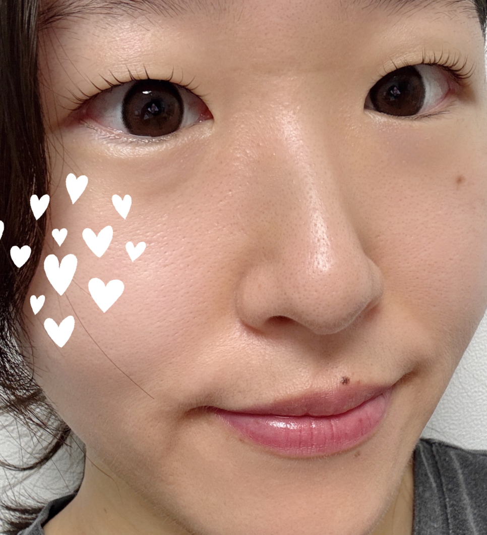 페르마타 사진 1