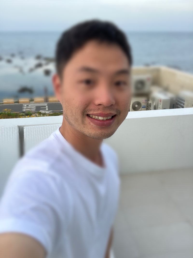 청담동 남자 레이저 제모 20회 찐후기 (내돈내산 후기)