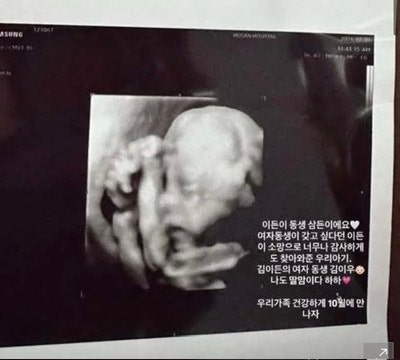 김민준 권다미 둘째 임신, 지드래곤도 또 삼촌 된다