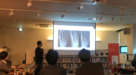 무지외반증 테이핑, 통증이 줄었다고 안심하면 안되는 이유? [족부 전담 전문의 작성]