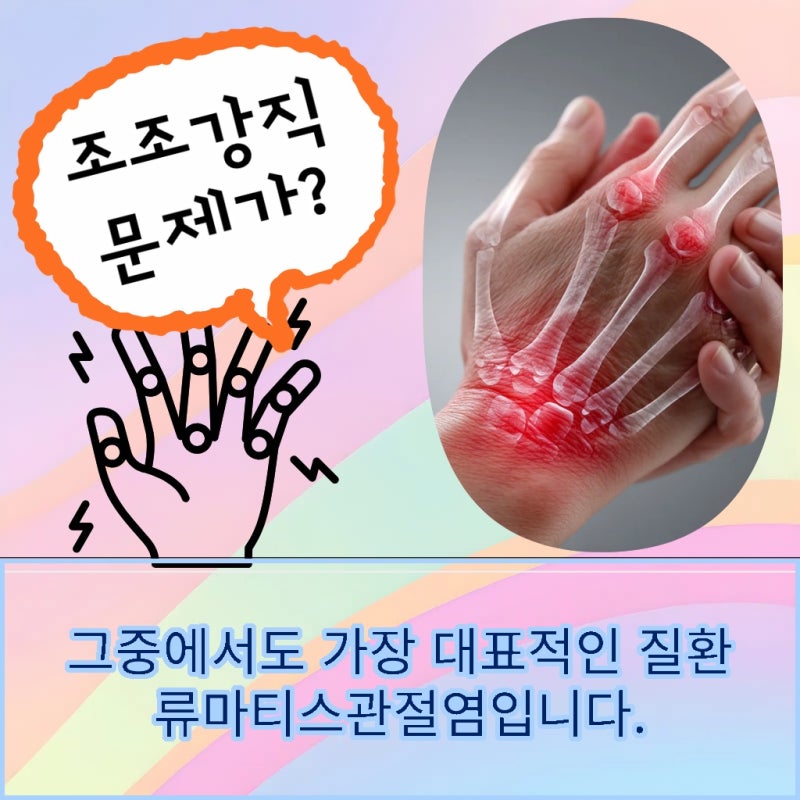 발가락 류마티스 관절염 다치지 않고 아픈 원인은?