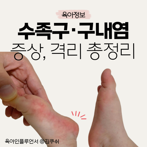 아기 구내염 수족구 차이, 증상부터 격리기간, 주의할 점 총정리