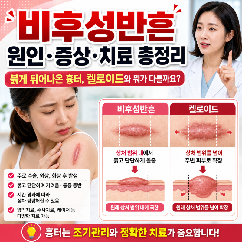 비후성반흔 원인·증상·치료 총정리 | 붉게 튀어나온 흉터, 켈로이드와 뭐가 다를까요?