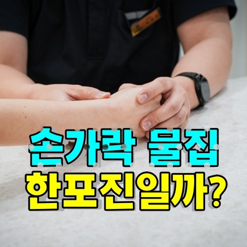 손가락 발 한포진 물집이 계속 생기는데 어쩌죠? 연고도 너무 가려워요
