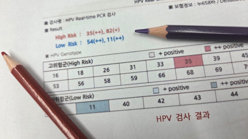 인유듀종바이러스 16 18 31 33 45 51 52 암으로 발전하는 순위