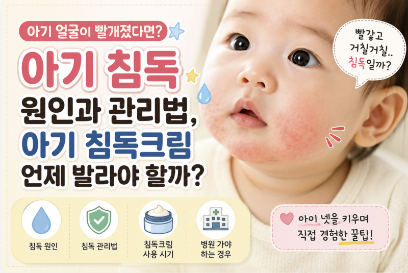 아기 침독 원인과 관리법 아기 침독크림 언제 발라야 할까?
